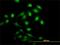 NME/NM23 Nucleoside Diphosphate Kinase 1 antibody, H00004830-M01, Novus Biologicals, Immunofluorescence image 