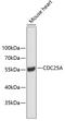 Cell Division Cycle 25A antibody, 18-766, ProSci, Western Blot image 