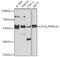 Patatin Like Phospholipase Domain Containing 2 antibody, GTX33419, GeneTex, Western Blot image 