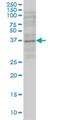 Gastrulation and brain-specific homeobox protein 2 antibody, H00002637-M03, Novus Biologicals, Western Blot image 