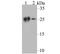 Carbonic Anhydrase 2 antibody, NBP2-76824, Novus Biologicals, Western Blot image 