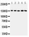 Thrombospondin 2 antibody, PA5-80123, Invitrogen Antibodies, Western Blot image 