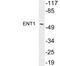 Solute Carrier Family 29 Member 1 (Augustine Blood Group) antibody, LS-C199845, Lifespan Biosciences, Western Blot image 