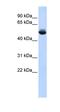 Translocation Associated Membrane Protein 1 Like 1 antibody, orb325807, Biorbyt, Western Blot image 