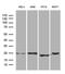 Eukaryotic Translation Initiation Factor 4E Family Member 3 antibody, MA5-27529, Invitrogen Antibodies, Western Blot image 