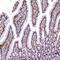 Aryl Hydrocarbon Receptor antibody, A00225-2, Boster Biological Technology, Immunohistochemistry paraffin image 