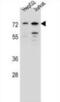 Dachshund Family Transcription Factor 2 antibody, abx027300, Abbexa, Western Blot image 