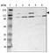 Phosphorylase Kinase Regulatory Subunit Alpha 1 antibody, HPA001081, Atlas Antibodies, Western Blot image 