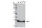 N(Alpha)-Acetyltransferase 10, NatA Catalytic Subunit antibody, 13357S, Cell Signaling Technology, Western Blot image 