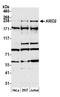 AT-rich interactive domain-containing protein 2 antibody, A302-230A, Bethyl Labs, Western Blot image 