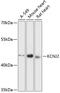 Potassium Voltage-Gated Channel Subfamily J Member 2 antibody, 14-718, ProSci, Western Blot image 