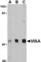 Mitochondrial Antiviral Signaling Protein antibody, A00169-2, Boster Biological Technology, Western Blot image 