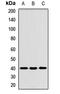 Tropomodulin 3 antibody, LS-C668745, Lifespan Biosciences, Western Blot image 