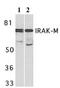 Interleukin 1 Receptor Associated Kinase 3 antibody, ab8116, Abcam, Western Blot image 