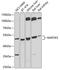 Mitogen-Activated Protein Kinase Kinase 5 antibody, A6953, ABclonal Technology, Western Blot image 