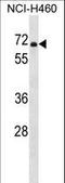 Phosphodiesterase 1B antibody, LS-C163468, Lifespan Biosciences, Western Blot image 