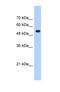 Interferon Induced Protein With Tetratricopeptide Repeats 3 antibody, NBP1-56632, Novus Biologicals, Western Blot image 