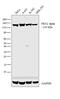 Protein Kinase N2 antibody, MA5-15887, Invitrogen Antibodies, Western Blot image 