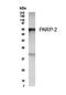 PARP2 antibody, NB100-185, Novus Biologicals, Western Blot image 