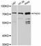Peptidyl Arginine Deiminase 2 antibody, LS-C747392, Lifespan Biosciences, Western Blot image 
