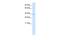 MAX Interactor 1, Dimerization Protein antibody, A08708, Boster Biological Technology, Western Blot image 