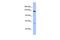 DExH-Box Helicase 34 antibody, GTX47515, GeneTex, Western Blot image 