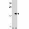 IL-17 antibody, F42568-0.4ML, NSJ Bioreagents, Western Blot image 
