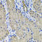 Activin A Receptor Type 2A antibody, LS-C331806, Lifespan Biosciences, Immunohistochemistry frozen image 
