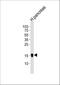 Regenerating Family Member 3 Alpha antibody, A05686-2, Boster Biological Technology, Western Blot image 