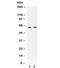 Pyruvate Kinase L/R antibody, R32061, NSJ Bioreagents, Western Blot image 