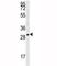 Tryptase Alpha/Beta 1 antibody, F40073-0.4ML, NSJ Bioreagents, Western Blot image 