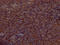 Bruton Tyrosine Kinase antibody, CSB-RA553167A0HU, Cusabio, Immunohistochemistry frozen image 