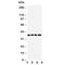 X-Ray Repair Cross Complementing 3 antibody, R30723, NSJ Bioreagents, Western Blot image 