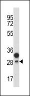 Protein C Receptor antibody, GTX81959, GeneTex, Western Blot image 