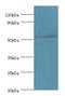 tRNA-splicing endonuclease subunit Sen2 antibody, LS-C378917, Lifespan Biosciences, Western Blot image 