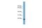 Cytochrome B-245 Alpha Chain antibody, GTX46749, GeneTex, Western Blot image 