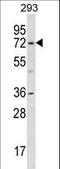 Potassium Voltage-Gated Channel Subfamily D Member 1 antibody, LS-C165416, Lifespan Biosciences, Western Blot image 