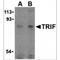 Toll Like Receptor Adaptor Molecule 1 antibody, MBS150991, MyBioSource, Western Blot image 