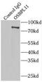 Oxysterol Binding Protein Like 11 antibody, FNab06018, FineTest, Immunoprecipitation image 