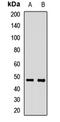 Solute Carrier Family 39 Member 14 antibody, LS-C668142, Lifespan Biosciences, Western Blot image 