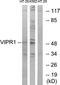 Vasoactive Intestinal Peptide Receptor 1 antibody, LS-C120970, Lifespan Biosciences, Western Blot image 