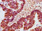 Janus Kinase 2 antibody, CSB-RA011931A100phHU, Cusabio, Immunohistochemistry frozen image 