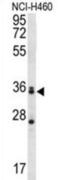 Muscleblind-like protein 3 antibody, abx027198, Abbexa, Western Blot image 