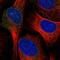 ELOVL Fatty Acid Elongase 1 antibody, HPA056557, Atlas Antibodies, Immunocytochemistry image 