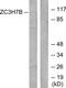 Zinc Finger CCCH-Type Containing 7B antibody, TA315233, Origene, Western Blot image 