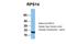 Ribosomal Protein S14 antibody, NBP1-57365, Novus Biologicals, Western Blot image 