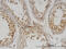 DNA Methyltransferase 1 Associated Protein 1 antibody, LS-C134088, Lifespan Biosciences, Immunohistochemistry paraffin image 