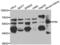 Fyn Related Src Family Tyrosine Kinase antibody, LS-C349239, Lifespan Biosciences, Western Blot image 
