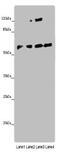 Angiopoietin Like 2 antibody, CSB-PA891539LA01HU, Cusabio, Western Blot image 