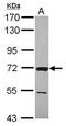 Zeta Chain Of T Cell Receptor Associated Protein Kinase 70 antibody, PA5-28697, Invitrogen Antibodies, Western Blot image 